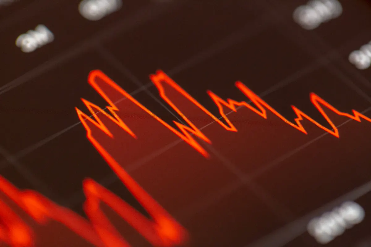 Американські акції понад $60 000 у спадщину: що загрожує рахункам в Interactive Brokers, XTB та Degiro після смерті інвестора
